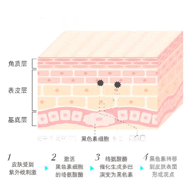 痘印反反复复怎么办,痘印一直反反复复怎么办