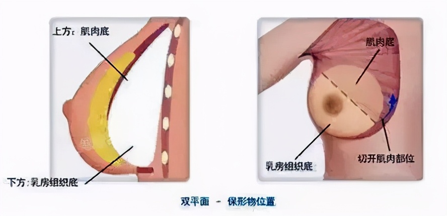 断奶喝回奶药还是自己憋回去,断奶憋奶