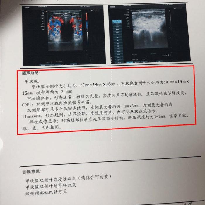 结节息肉囊肿增生哪个更容易癌变,结节囊肿增生息肉有什么区别