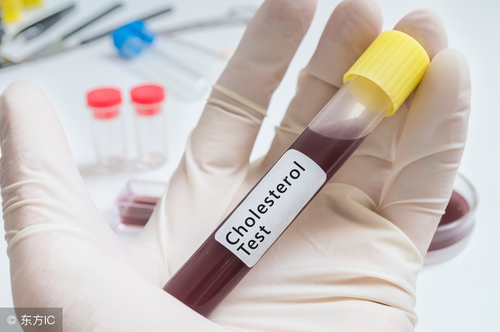 甘油三酯高6.3不吃药也能恢复正常,甘油三酯高5.4胆固醇不高怎么回事