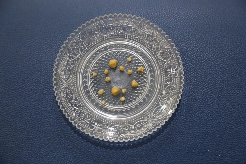 37岁高血压做胆结石手术,高龄老人高血压胆结石怎么办