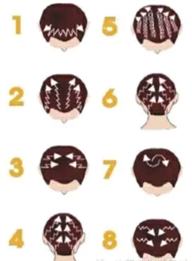 脱发掉发秃顶你该了解生发方法了,男士脱发秃顶怎么才能长出头发