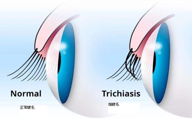 猫咪泪痕太严重是什么原因,猫咪泪痕的解决办法是什么