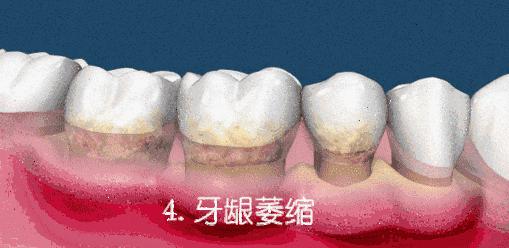 推荐一个好用的液体牙膏,人气火爆的可食用牙膏