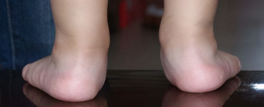 骨科医生的忠告,骨科大夫建议买的鞋子