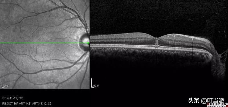 警惕这种笔容易伤害视力,损害视力的新型文具