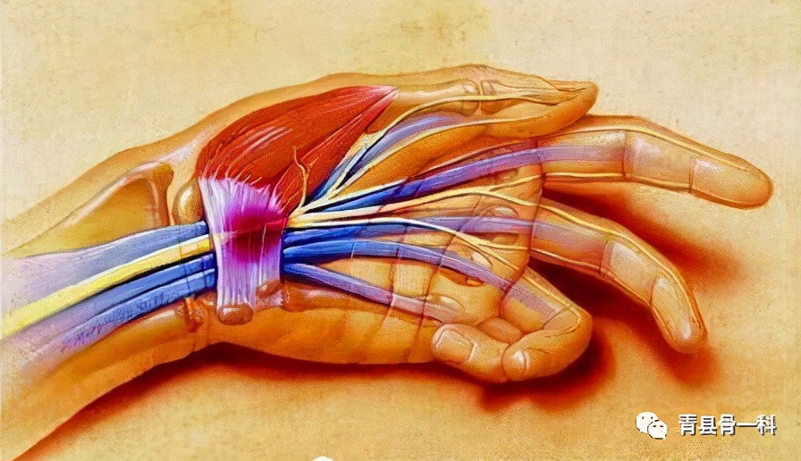 手指肌腱断裂怎么连接,小指第一节肌腱断裂肌腱粘连症状