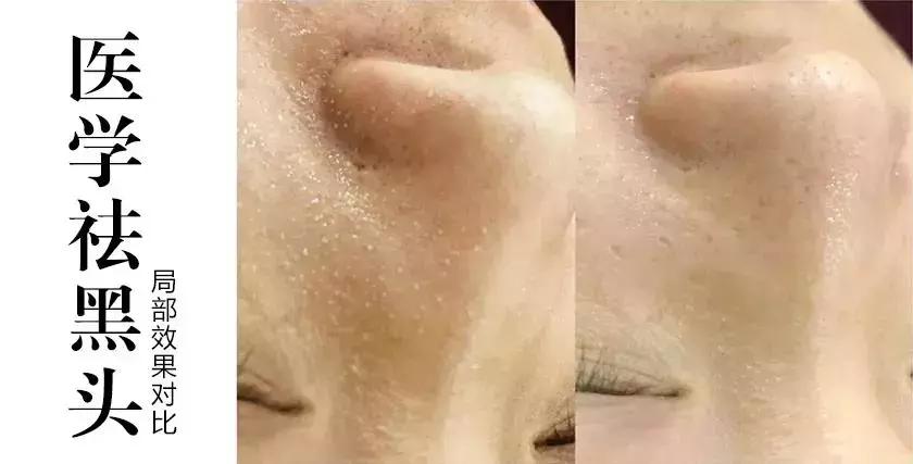 2人同行一人免单北京生日,厦门2人同行1人免单