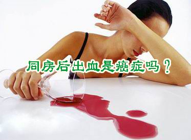 宫颈癌变的根源,宫颈腺体感染癌变