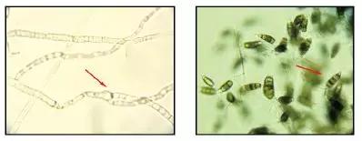 草莓红叶病最佳治疗方法,草莓突然蔫了怎么办
