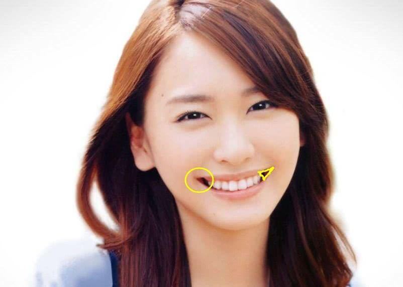 牙齿美学修复的缺点,大龄牙齿矫正经历和感受