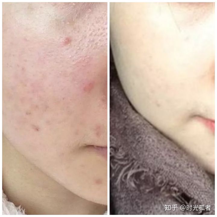 人有没有前世,人有没有前世来世