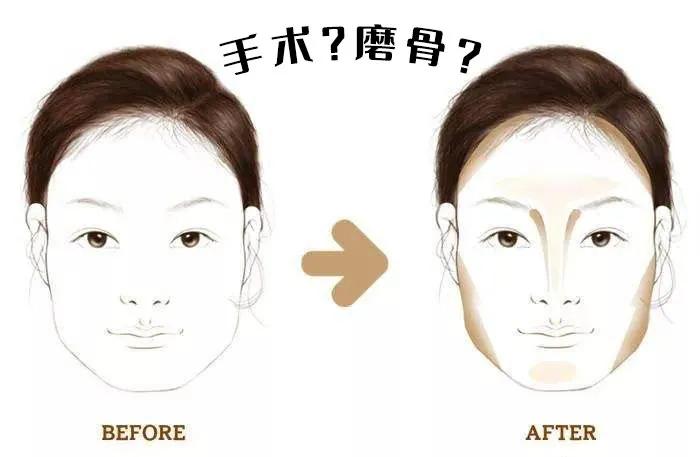 两边颧骨不一样大小如何调整,如何判断颧骨外扩还是颧骨突出