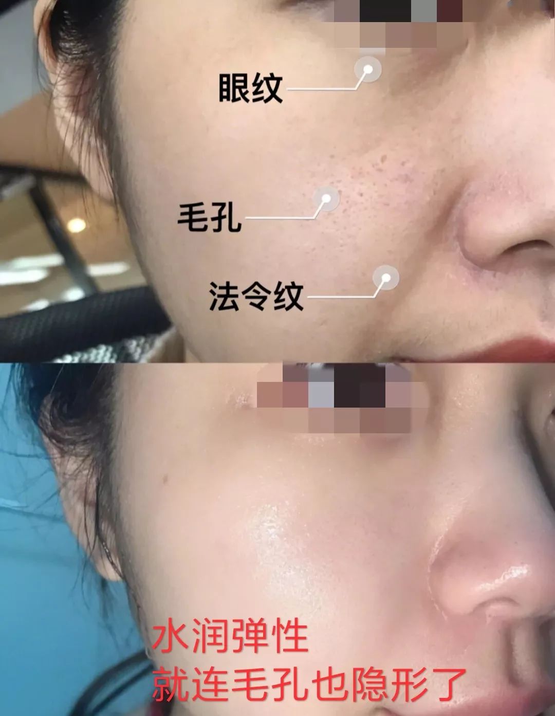 一年四季都能用的保湿面霜,皮肤干推荐一款好用的面霜