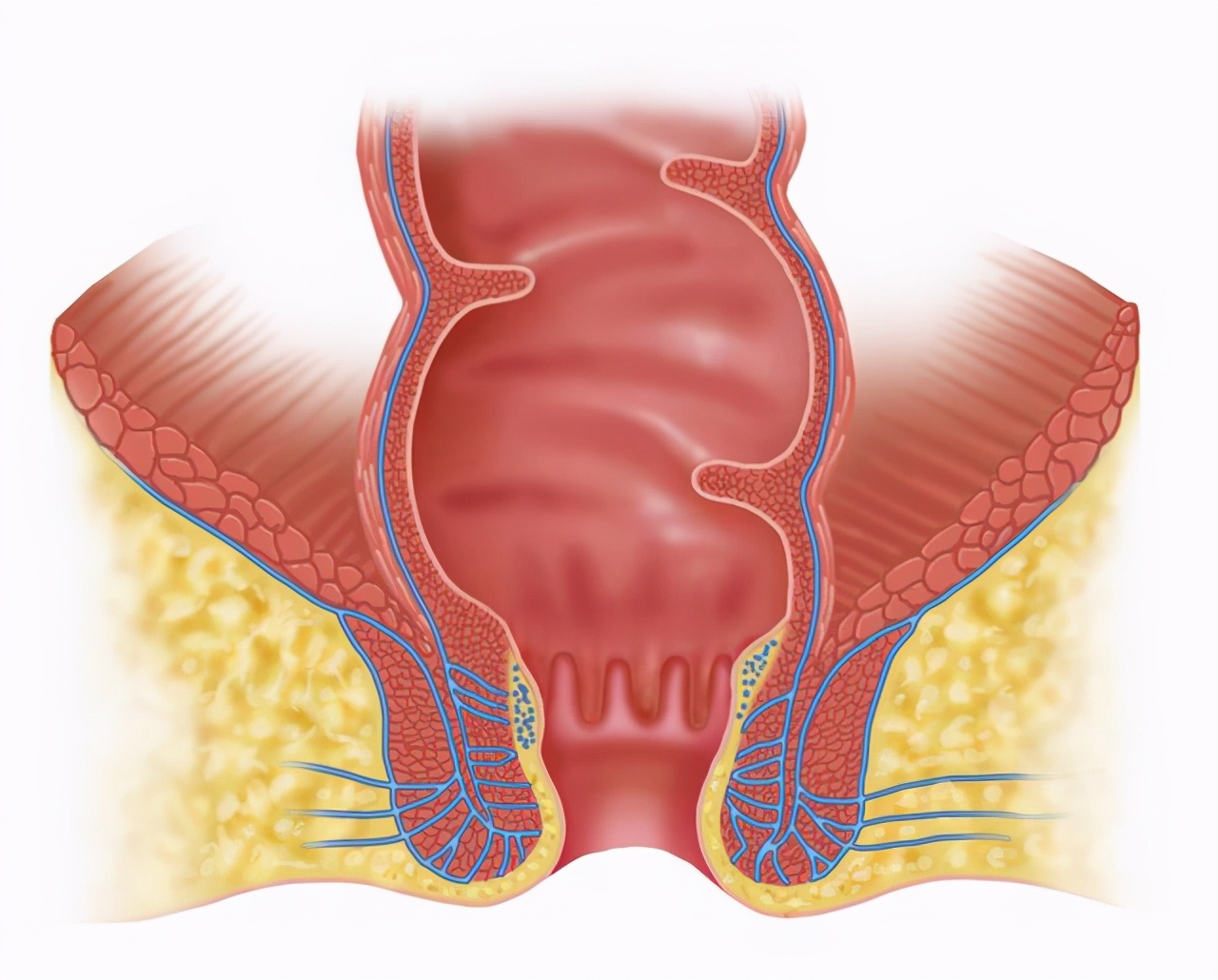肛门疼肿就是痔疮？痔疮：这个黑锅我不背