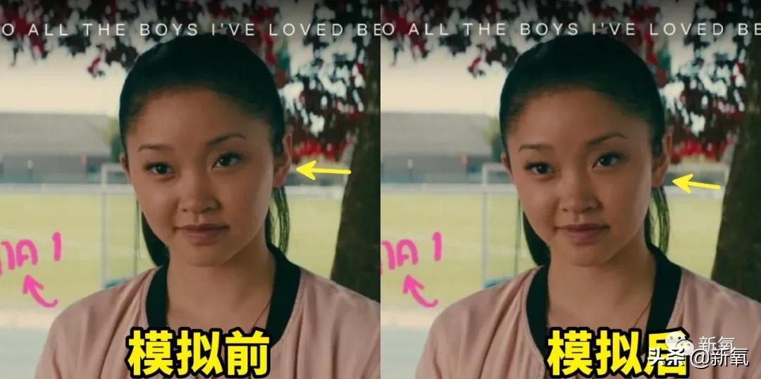 阔面脸轮廓怎么做,阔面脸怎么做医美