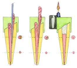 根管治疗后需要套冠么,根管治疗后冠修复一般多少钱