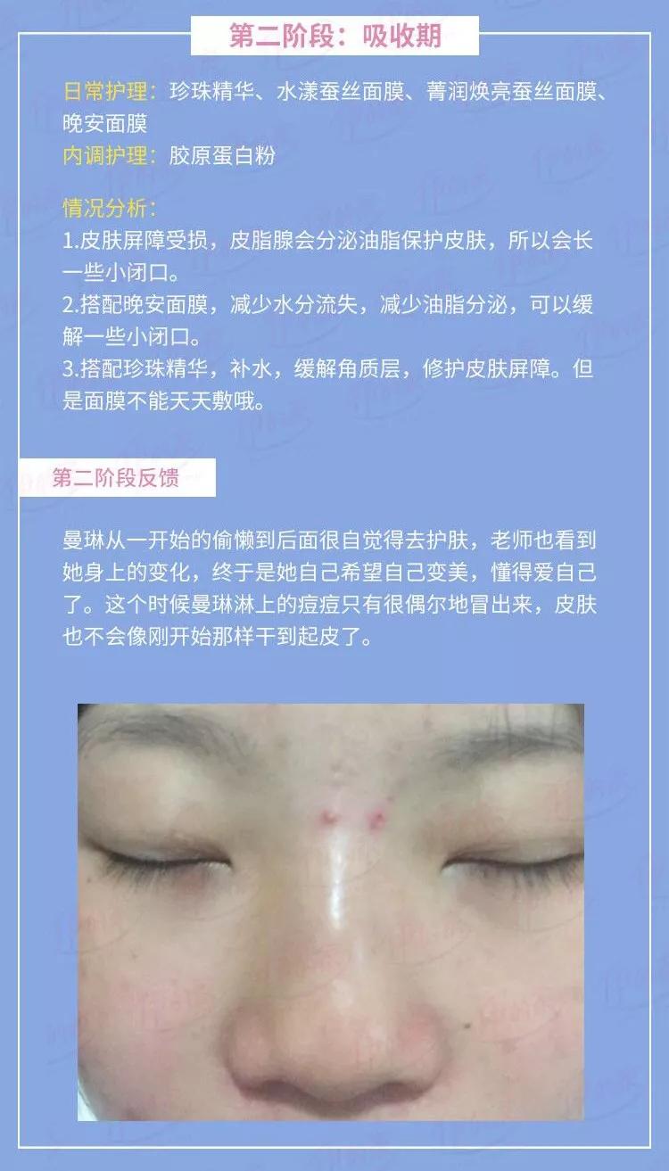 在成长的过程中，你是否也曾对自己的颜值不满意？