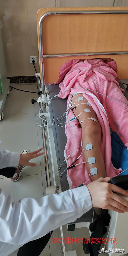 偏瘫和疼痛的物理治疗选择