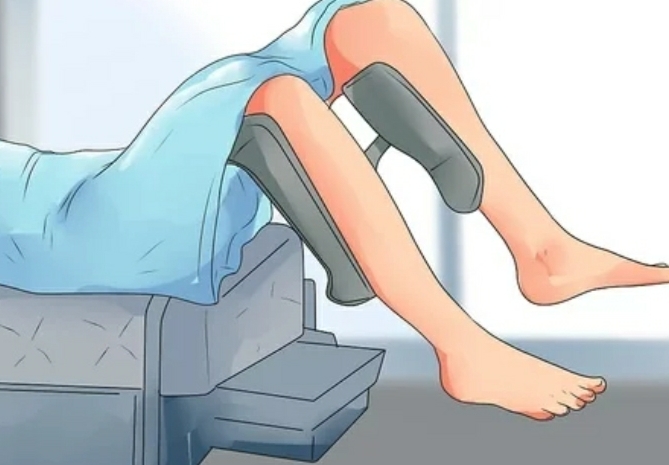 阴道松弛症,凯格尔训练无效怎么办?