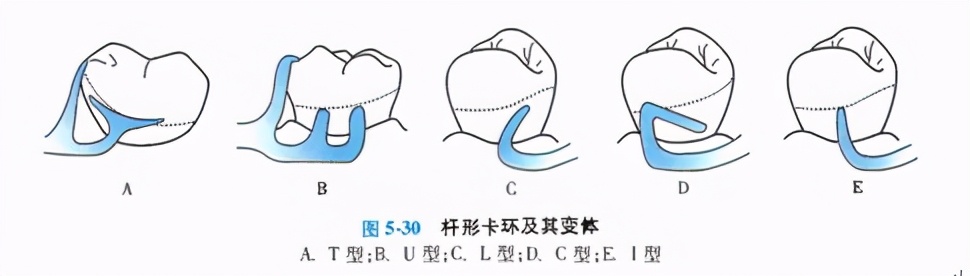 牙列缺损的可摘局部义齿修复题库,牙科美学修复精讲