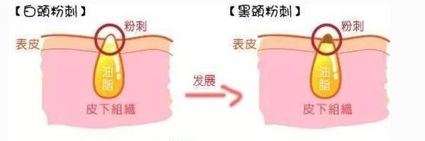 你以为的闭口不一定是闭口,你以为的直言不讳其实是口无遮拦