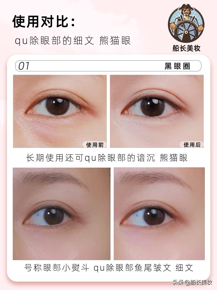 超级实用眼膜淡化黑眼圈男女通用,抗皱去黑眼圈眼膜推荐直播