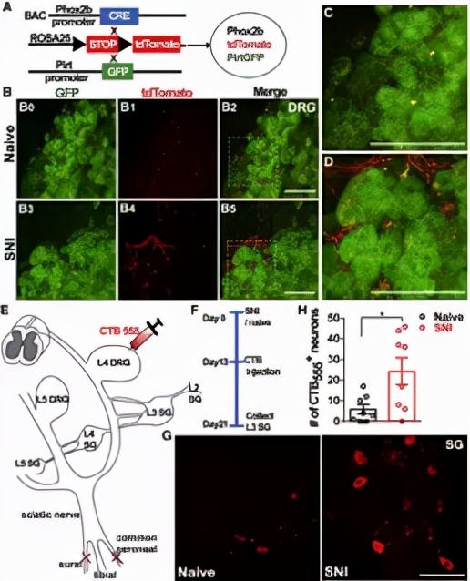 Neuron：董欣中/张俊明合作揭示神经损伤后自发性疼痛产生新机制