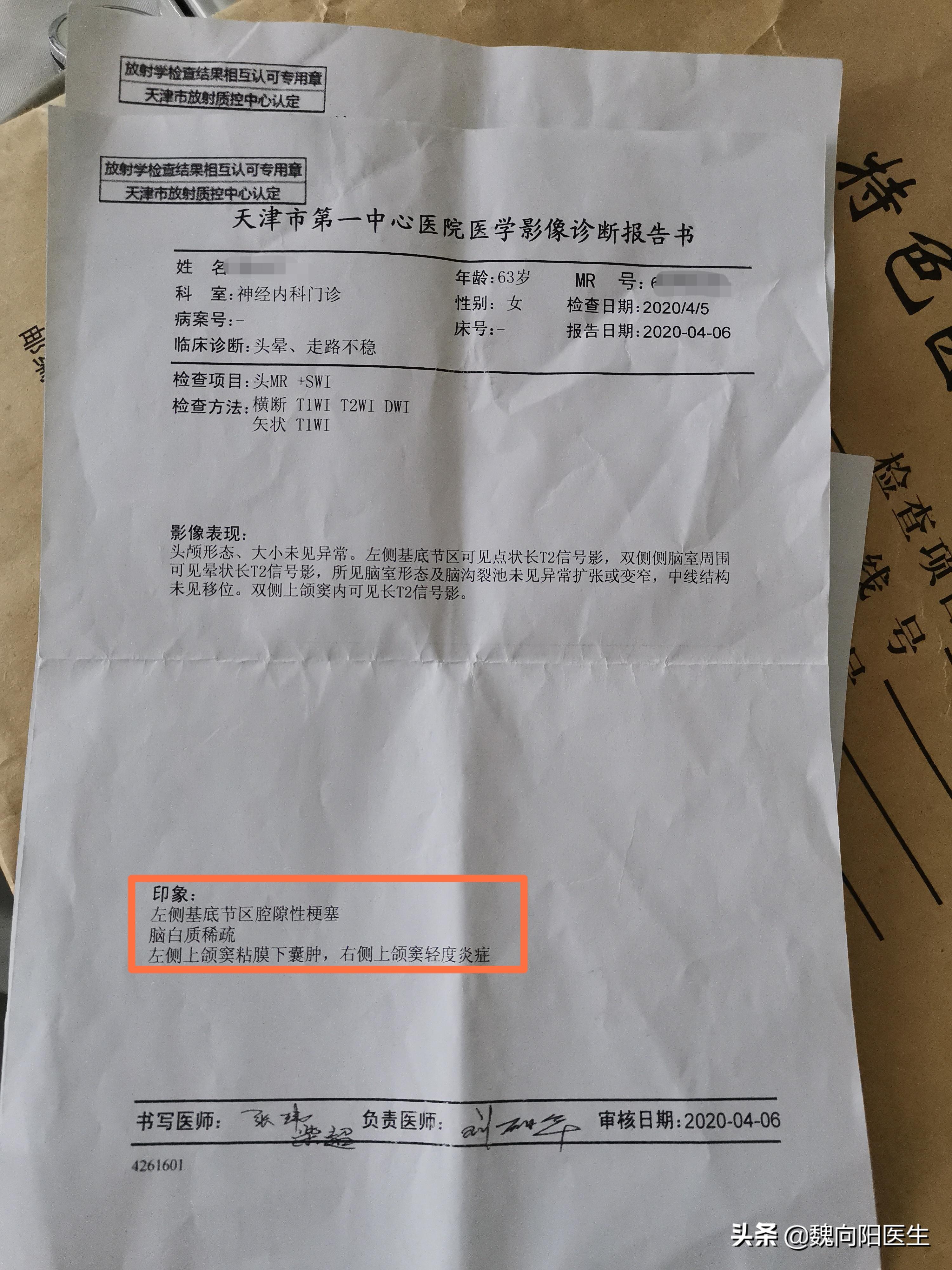 体检发现脑梗要住院吗,体检查出腔隙性脑梗塞需要治疗吗