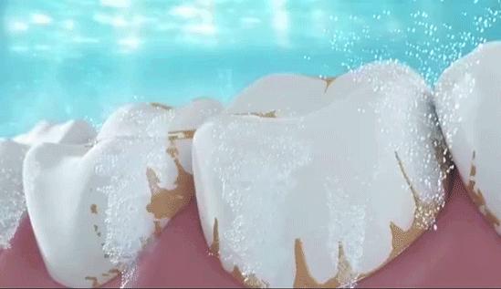 一张嘴就臭是咋回事,刷牙不管用的口臭怎么治