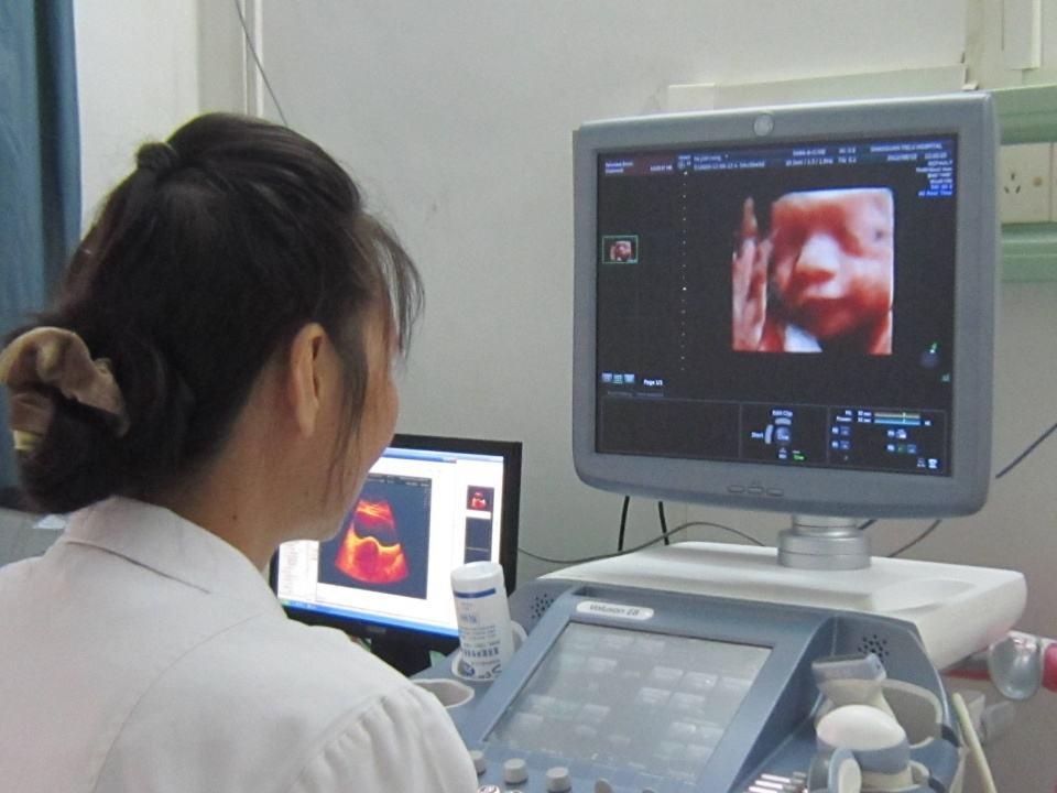 孕妇套话医生问男女，被识破臊一脸，这7项看男女的说法有效吗？