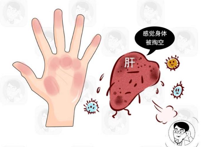 早期体内有癌怎么查才知道,身体里有癌手脚先告诉你什么症状