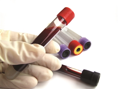 早上空腹5.8饭后11.7是糖尿病了吗,糖尿病空腹7.0餐后2小时7.8正常吗