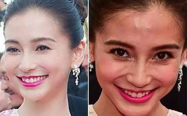 混油痘用什么卸妆品好,皮肤出油长痘严重如何改善