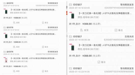 j-style脱毛仪,j-style脱毛仪怎么样