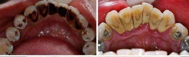 李湘贵妇,李湘美白牙膏