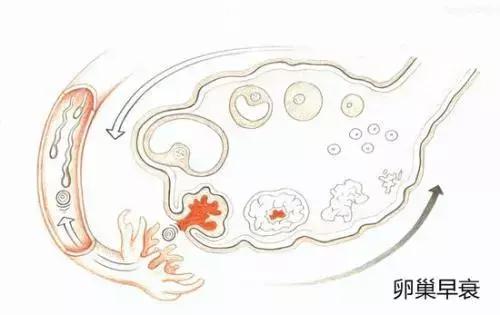 卵巢早衰，人易老！这5种表现都在告诉你：不保护就老了