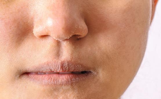 如何正确敷面膜补水效果好,坚持敷面膜好不好用