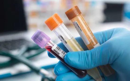 验孕棒可以测血hcg吗,验孕棒hcg数值多少可以检测出