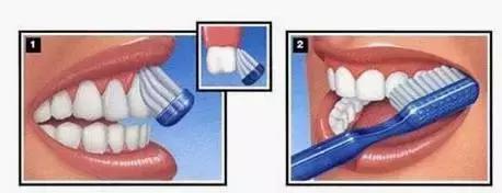 5元和40元牙膏的区别,5元与35元的牙膏有什么区别