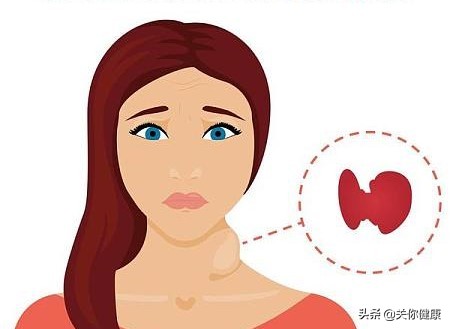 女性下肢轻度水肿是什么引起的,女性水肿的治疗效果