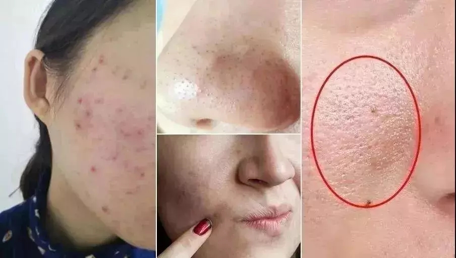 秋冬补水面霜推荐！高保湿不仅有科颜氏，珂润也不赖