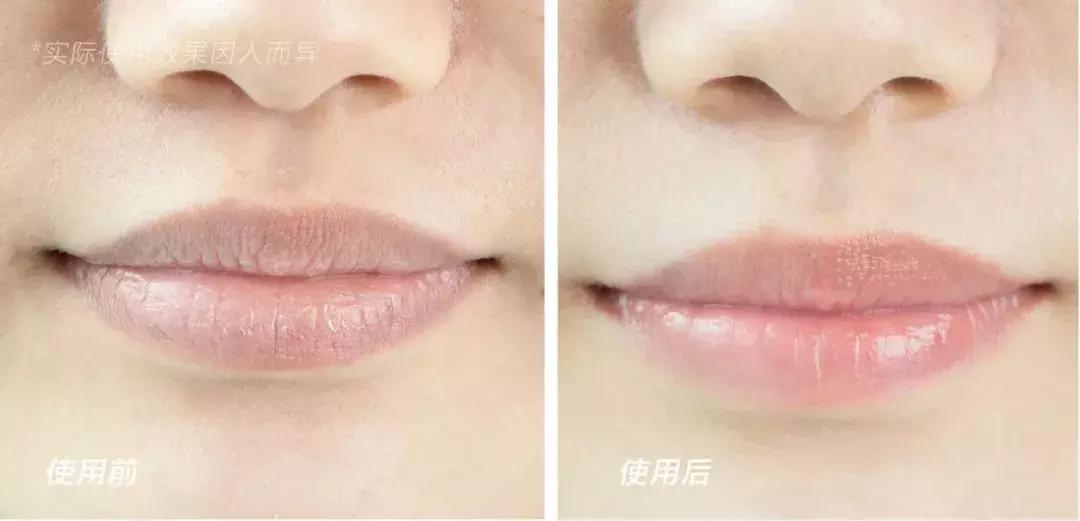 唇炎唇干起皮用什么唇膏,干唇救星唇膏