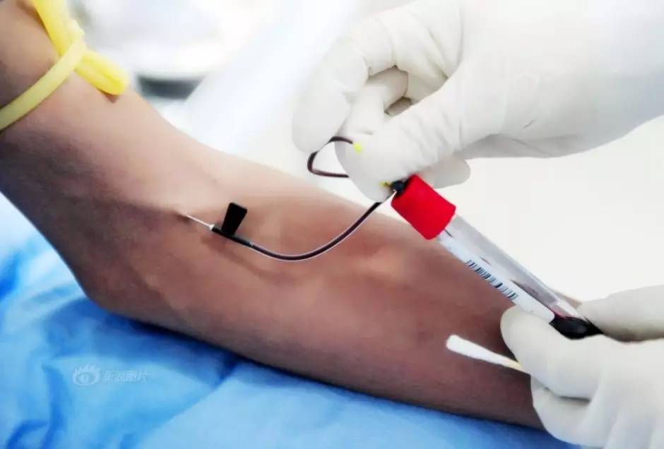 抽血完怎么不留淤青,抽血后如何按压止血