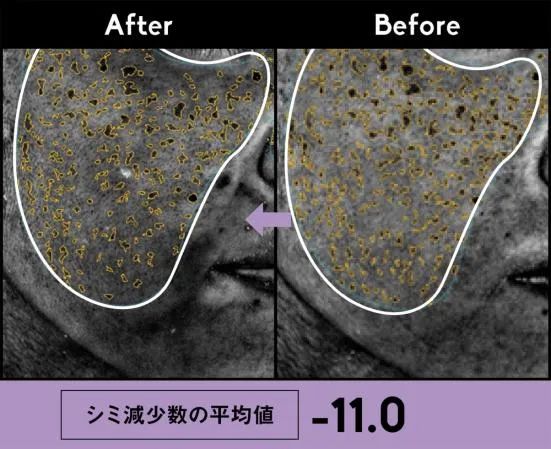 贵妇美白精华测评,不花冤枉钱国货推荐