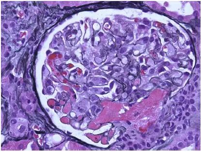 肾毒性的药物排名,肾毒性食物有哪些