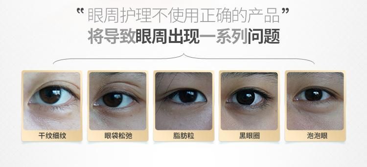 资生堂微针眼膜好不好用,日本资生堂小熨斗眼膜