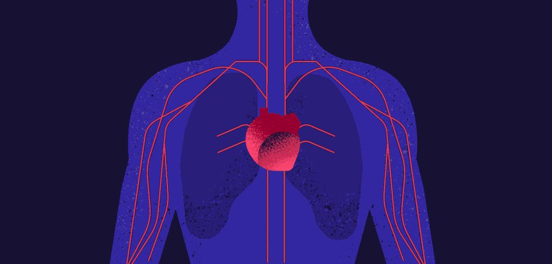 心脏引起的眼皮肿的图片,心血管病人眼睛充血怎么回事