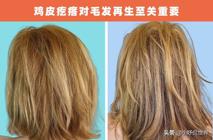 冷知识9个有趣,冷知识鸡皮疙瘩