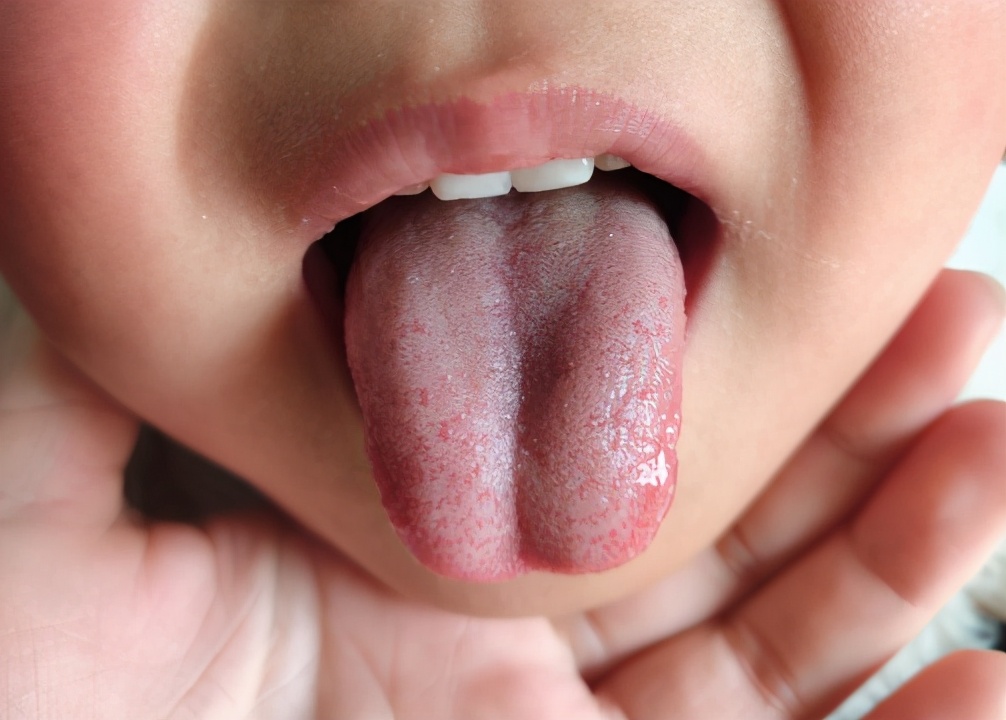 气阴两虚伴有湿热体质怎么调理,阴阳两虚的孩子最佳治疗方法